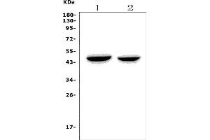 Western blot analysis of NDRG1 using anti-NDRG1 antibody (ABIN7600474).
