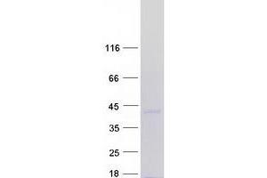 Validation with Western Blot