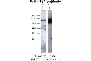 Image no. 2 for anti-Transglutaminase 1, Keratinocyte (TGM1) antibody (ABIN347015) (TGM1 antibody)