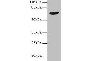 Western blot All lanes: GRK4 antibody at 2 μg/mL + Jurkat whole cell lysate Secondary Goat polyclonal to rabbit IgG at 1/10000 dilution Predicted band size: 67, 64, 58, 62 kDa Observed band size: 67 kDa
