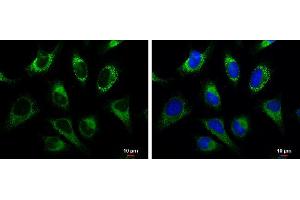 ICC/IF Image GRP94 antibody detects GRP94 protein at cytoplasm by immunofluorescent analysis.