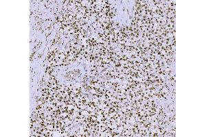 IHC analysis of SCP3/SYCP3 using anti-SCP3/SYCP3 antibody (ABIN7602415).