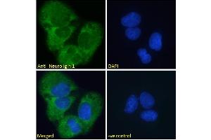ABIN185446 Immunofluorescence analysis of paraformaldehyde fixed U2OS cells, permeabilized with 0. (Neuroligin 1 antibody  (Internal Region))