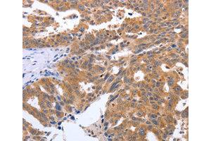 Immunohistochemistry (IHC) image for anti-Gem (Nuclear Organelle) Associated Protein 2 (GEMIN2) antibody (ABIN1872798) (SIP1 antibody)