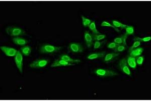 Immunofluorescent analysis of Hela cells using ABIN7168160 at dilution of 1:100 and Alexa Fluor 488-congugated AffiniPure Goat Anti-Rabbit IgG(H+L) (PRPS2 antibody  (AA 11-106))