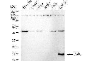 Western blotting analysis using LY6A antibody (ABIN7799289).