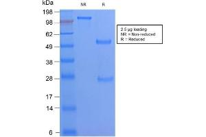 SDS-PAGE Analysis Purified CD68 Rabbit Recombinant Monoclonal Antibody (C68/2908R). (Recombinant CD68 antibody)