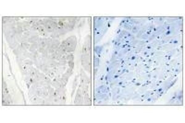 ALPK2 antibody