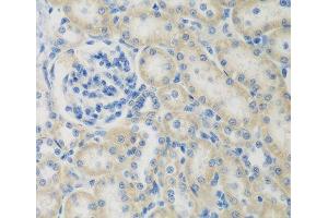 Immunohistochemistry of paraffin-embedded Rat kidney using CCL26 Polyclonal Antibody at dilution of 1:200 (40x lens). (CCL26 antibody)