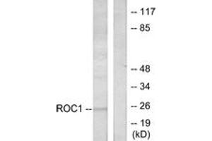Western blot analysis of extracts from Jurkat cells, using RIT1 Antibody. (RIT1 antibody  (AA 170-219))