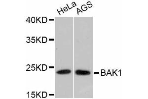 Western blot analysis of extracts of various cell lines, using BAK1 antibody (ABIN4903006). (BAK1 antibody)