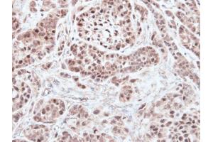 IHC-P Image Immunohistochemical analysis of paraffin-embedded A549 xenograft, using RNF13, antibody at 1:500 dilution. (RNF13 antibody  (C-Term))