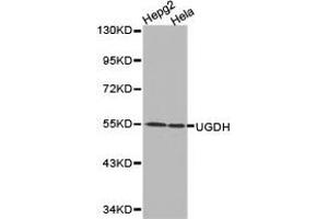 Western Blotting (WB) image for anti-UDP-Glucose 6-Dehydrogenase (UGDH) antibody (ABIN1875273) (UGDH antibody)