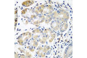 Immunohistochemistry of paraffin-embedded human stomach using PLS3 antibody at dilution of 1:100 (40x lens).