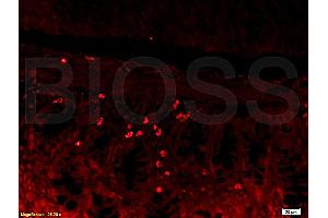 Formalin-fixed and paraffin embedded mouse kidney tissue labeled with Rabbit Anti-L-Selectin/CD62L Polyclonal Antibody (ABIN736716), Unconjugated 1:200 followed by conjugation to the secondary antibody and DAB staining (L-Selectin antibody  (AA 301-372))