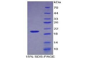 SDS-PAGE (SDS) image for Interleukin 17 (IL17) (AA 20-155) protein (His tag) (ABIN2125456)