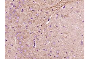 Paraformaldehyde-fixed, paraffin embedded Rat brain Antigen retrieval by boiling in sodium citrate buffer (pH6. (NFATC1 antibody  (AA 601-716))