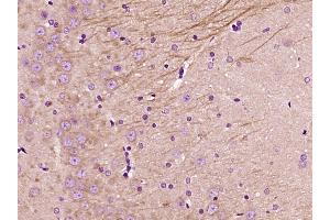 Paraformaldehyde-fixed, paraffin embedded Rat brain Antigen retrieval by boiling in sodium citrate buffer (pH6.