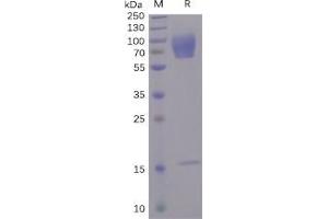 Human CD30 Protein, His Tag on SDS-PAGE under reducing condition. (TNFRSF8 Protein (His tag))