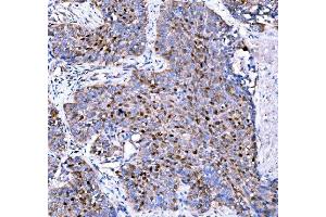 IHC analysis of p57 Kip2/CDKN1C using anti-p57 Kip2/CDKN1C antibody (ABIN7603232). (CDKN1C antibody  (N-Term))
