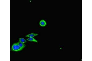 Immunofluorescent analysis of HepG2 cells using ABIN7148044 at dilution of 1:100 and Alexa Fluor 488-congugated AffiniPure Goat Anti-Rabbit IgG(H+L) (Cofilin antibody  (AA 4-144))