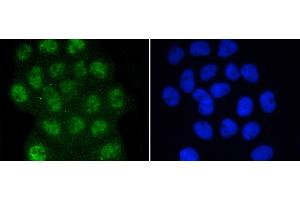 A431 were fixed in paraformaldehyde, permeabilized with 0. (SMAD3 antibody  (pSer423, pSer425))