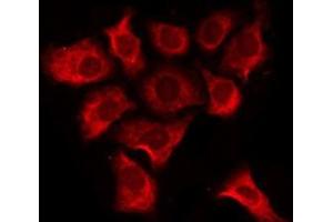 ABIN6276225 staining COLO205 by IF/ICC. (TAS2R20 antibody  (Internal Region))