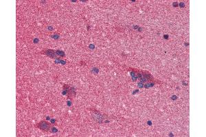 Anti-SNCA / Alpha-Synuclein antibody IHC of human brain, cortex.