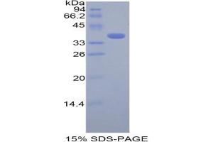 SDS-PAGE analysis of Mouse Cystatin A Protein. (CSTA Protein)