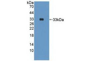 Western blot analysis of recombinant Human PIK3Cd.