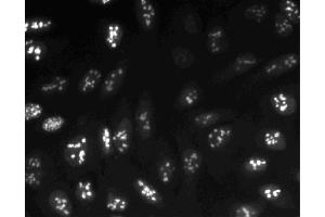 Immunofluorescent staining of U-2 OS (ATCC HTB-96) cells. (Ki-67 antibody  (AA 1547-1742))