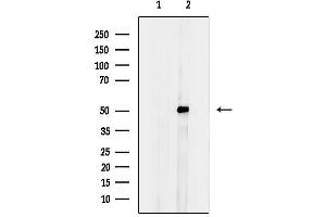 anti-Glucosaminyl (N-Acetyl) Transferase Family Member 7 (GCNT7) (Internal Region) antibody