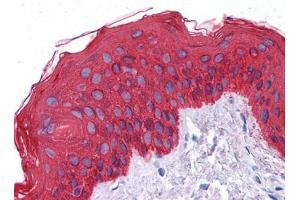 Immunohistochemical analysis of paraffin-embedded human Skin tissues using CK mouse mAb (Cytokeratin 1 antibody)