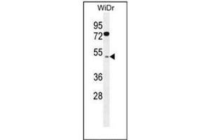 Western blot analysis of FAM82B Antibody (N-term) in WiDr cell line lysates (35ug/lane). (FAM82B antibody  (N-Term))