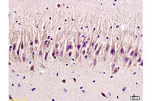 HTR2A antibody  (AA 65-160)