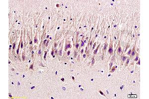 Formalin-fixed and paraffin embedded rat brain labeled with Rabbit Anti 5-HTR2A/HTR2A Polyclonal Antibody, Unconjugated (ABIN737016) at 1:200 followed by conjugation to the secondary antibody and DAB staining (HTR2A antibody  (AA 65-160))