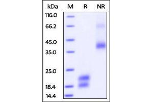 Biotinylated Human VEGF121, His Tag on SDS-PAGE under reducing (R) and no-reducing (NR) conditions. (VEGF Protein (AA 27-147) (AVI tag,His tag,Biotin))