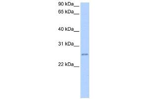 WB Suggested Anti-RPESP Antibody Titration: 0. (RPESP antibody  (C-Term))