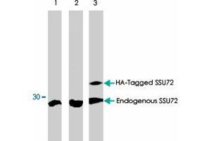 Western blot analysis using SSU72 polyclonal antibody  on MCF-7 (1), COS-7 (2) and COS-7 cells transfected with HA-Tagged SSU72 protein (3). (SSU72 antibody)