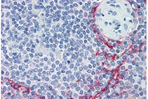 Human Spleen (formalin-fixed, paraffin-embedded) stained with MADCAM1 antibody ABIN462006 at 10 ug/ml followed by biotinylated anti-mouse IgG secondary antibody ABIN481714, alkaline phosphatase-streptavidin and chromogen. (MADCAM1 antibody)
