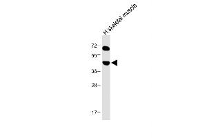 Western Blotting (WB) image for anti-Keratocan (KERA) (AA 228-257), (C-Term) antibody (ABIN656548)