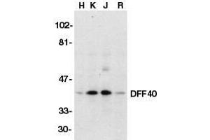 Western blot analysis of DFF40/CAD in HeLa (H), K562 (K), Jurkat (J), and Raji (R) whole cell lysate with DFF40/CAD antibody at 1μg/ml. (DFFB antibody  (AA 147-164))