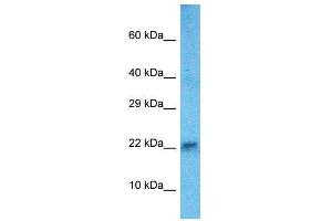 Host:  Rabbit  Target Name:  Hand2  Sample Type:  Mouse Heart lysates  Antibody Dilution:  1.