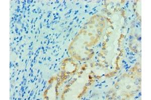 Immunohistochemistry of paraffin-embedded human kidney tissue using ABIN7165064 at dilution of 1:100 (PRMT1 antibody  (AA 20-353))