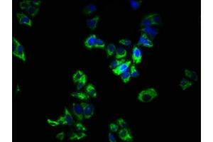 Immunofluorescence staining of PC-3 cells with ABIN7166148 at 1:266, counter-stained with DAPI. (SPRY1 antibody  (AA 1-178))