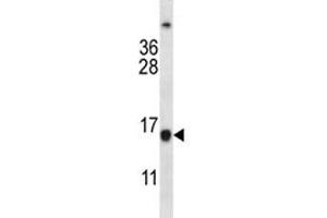 BCL2 antibody western blot analysis in Jurkat lysate (Bcl-2 antibody  (AA 86-114))