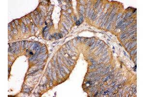Immunohistochemistry (Paraffin-embedded Sections) (IHC (p)) image for anti-TF (AA 20-49), (N-Term) antibody (ABIN3043419) (TF (AA 20-49), (N-Term) antibody)