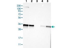 Western blot analysis of Lane 1: RT-4, Lane 2: U-251 MG, Lane 3: Human Plasma, Lane 4: Liver, Lane 5: Tonsil with KCTD10 polyclonal antibody  at 1:250-1:500 dilution.