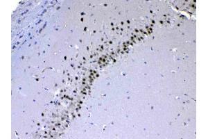 IHC analysis of CHD2 using anti-CHD2 antibody . (CHD2 antibody  (AA 1124-1351))