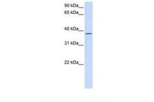 Image no. 1 for anti-Chromosome 21 Open Reading Frame 91 (C21orf91) (AA 182-231) antibody (ABIN6738191) (C21orf91 antibody  (AA 182-231))